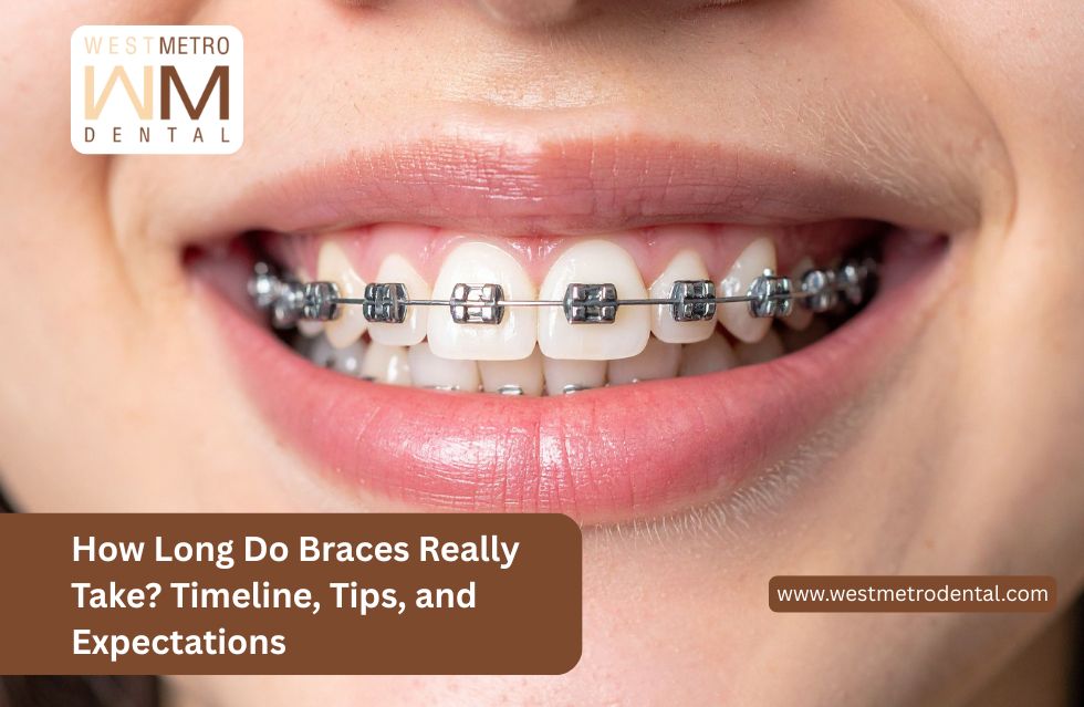 How Long Do Braces Really Take? Timeline, Tips, and Expectations